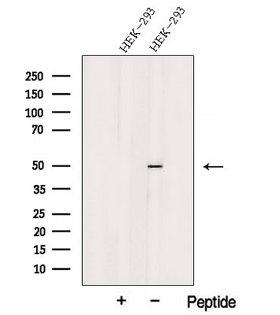 PRSS50 / TSP50 Antibody - Western blot analysis of extracts of HEK293 cells using TSP50 antibody. The lane on the left was treated with blocking peptide.