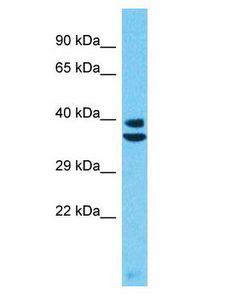 PRSS55 Antibody - PRSS55 antibody Western Blot of HepG2. Antibody dilution: 1 ug/ml.  This image was taken for the unconjugated form of this product. Other forms have not been tested.