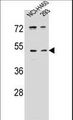 PRSS55 Antibody - UNQ9391 Antibody western blot of NCI-H460,293 cell line lysates (35 ug/lane). The UNQ9391 antibody detected the UNQ9391 protein (arrow).
