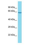 PRSS56 Antibody - PRSS56 antibody Western Blot of Fetal Lung. Antibody dilution: 1 ug/ml.  This image was taken for the unconjugated form of this product. Other forms have not been tested.
