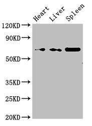 PRSS56 Antibody - Positive WB detected in:Rat heart tissue,Rat liver tissue,Rat spleen tissue;All lanes:PRSS56 antibody at 3?g/ml;Secondary;Goat polyclonal to rabbit IgG at 1/50000 dilution;Predicted band size: 65 KDa;Observed band size: 65 KDa;