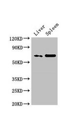PRSS56 Antibody - Western Blot Positive WB detected in: Rat heart tissue, Rat liver tissue, Rat spleen tissue All lanes: PRSS56 antibody at 3µg/ml Secondary Goat polyclonal to rabbit IgG at 1/50000 dilution Predicted band size: 65 kDa Observed band size: 65 kDa