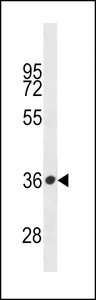 PRSS57 Antibody - PRSSL1 Antibody western blot of A549 cell line lysates (35 ug/lane). The PRSSL1 antibody detected the PRSSL1 protein (arrow).