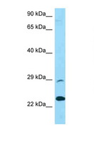 PRSS58 Antibody - PRSS58 antibody Western blot of U937 Cell lysate. Antibody concentration 1 ug/ml.  This image was taken for the unconjugated form of this product. Other forms have not been tested.
