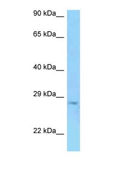 PRSS58 Antibody - PRSS58 antibody Western blot of Jurkat Cell lysate. Antibody concentration 1 ug/ml.  This image was taken for the unconjugated form of this product. Other forms have not been tested.