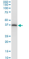 PRSS8 / Prostasin Antibody - PRSS8 monoclonal antibody (M11A), clone 3C4. Western Blot analysis of PRSS8 expression in PC-12.