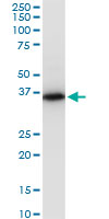 PRSS8 / Prostasin Antibody - PRSS8 monoclonal antibody (M11A), clone 3C4. Western Blot analysis of PRSS8 expression in HepG2.