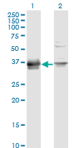 PRSS8 / Prostasin Antibody - Western Blot analysis of PRSS8 expression in transfected 293T cell line by PRSS8 monoclonal antibody (M11A), clone 3C4.Lane 1: PRSS8 transfected lysate (Predicted MW: 36.4 KDa).Lane 2: Non-transfected lysate.