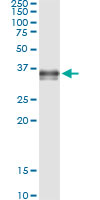 PRSS8 / Prostasin Antibody - Immunoprecipitation of PRSS8 transfected lysate using anti-PRSS8 monoclonal antibody and Protein A Magnetic Bead, and immunoblotted with PRSS8 rabbit polyclonal antibody.