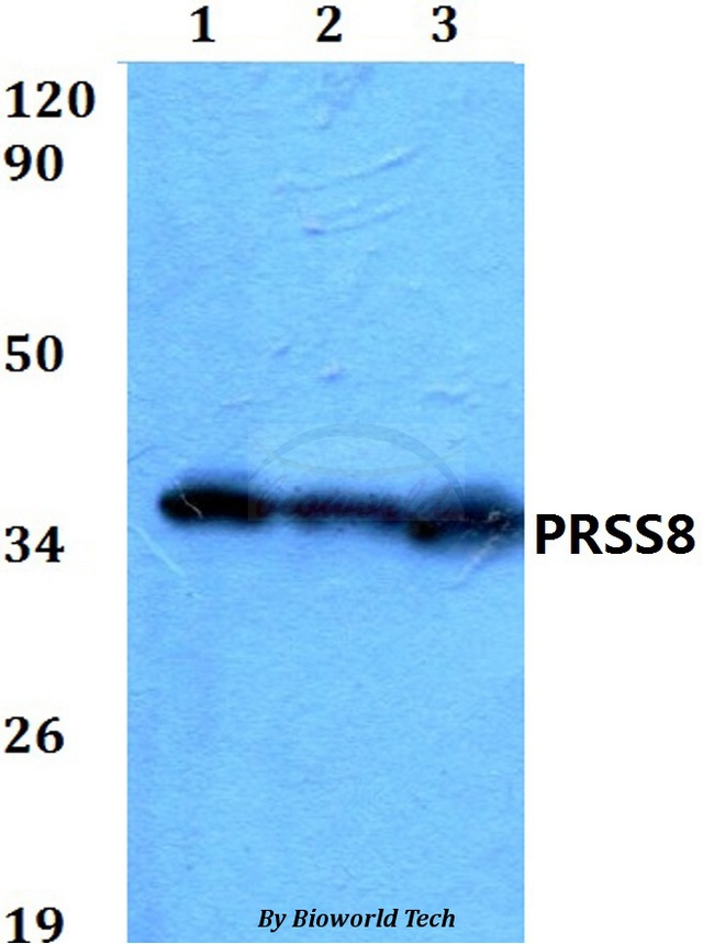 PRSS8 / Prostasin Antibody - Western blot of PRSS8 antibody at 1:500 dilution. Lane 1: HEK293T whole cell lysate. Lane 2: Raw264.7 whole cell lysate. Lane 3: PC12 whole cell lysate.