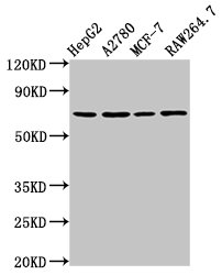 PRSS8 / Prostasin Antibody - Positive Western Blot detected in HepG2 whole cell lysate, A2780 whole cell lysate, MCF-7 whole cell lysate, RAW264.7 whole cell lysate. All lanes: PRSS8 antibody at 2 µg/ml Secondary Goat polyclonal to rabbit IgG at 1/50000 dilution. Predicted band size: 37, 31 KDa. Observed band size: 70 KDa