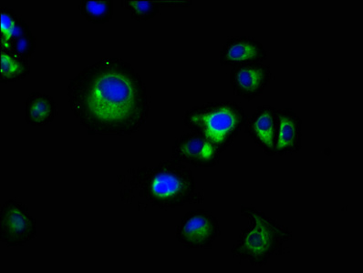 PRSS8 / Prostasin Antibody - Immunofluorescence staining of MCF-7 cells with PRSS8 Antibody at 1:66, counter-stained with DAPI. The cells were fixed in 4% formaldehyde, permeabilized using 0.2% Triton X-100 and blocked in 10% normal Goat Serum. The cells were then incubated with the antibody overnight at 4°C. The secondary antibody was Alexa Fluor 488-congugated AffiniPure Goat Anti-Rabbit IgG(H+L).