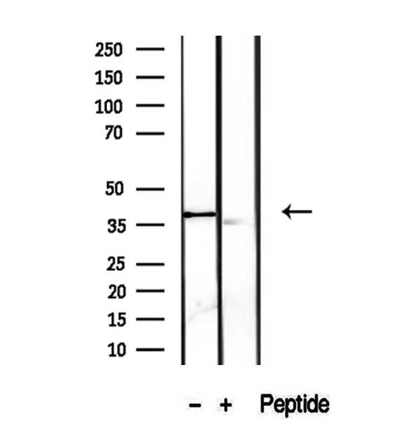 PRSS8 / Prostasin Antibody - Western blot analysis of extracts of A2780 cells using PRSS8 antibody.