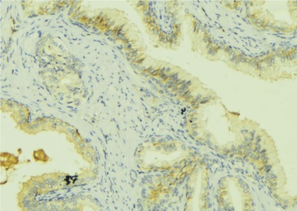 PRSS8 / Prostasin Antibody - 1:100 staining mouse colon tissue by IHC-P. The sample was formaldehyde fixed and a heat mediated antigen retrieval step in citrate buffer was performed. The sample was then blocked and incubated with the antibody for 1.5 hours at 22°C. An HRP conjugated goat anti-rabbit antibody was used as the secondary.