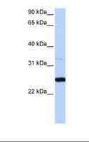 PRTFDC1 / HHGP Antibody - HepG2 cell lysate. Antibody concentration: 0.5 ug/ml. Gel concentration: 12%.  This image was taken for the unconjugated form of this product. Other forms have not been tested.