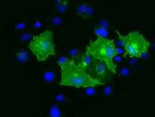 PRTG Antibody - Anti-PRTG mouse monoclonal antibody  immunofluorescent staining of COS7 cells transiently transfected by pCMV6-ENTRY PRTG.