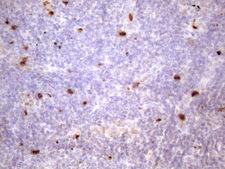 PRTN3 / Myeloblastin Antibody - Immunohistochemical staining of paraffin-embedded Human lymph node tissue within the normal limits using anti-PRTN3 mouse monoclonal antibody. (Heat-induced epitope retrieval by 1 mM EDTA in 10mM Tris, pH8.5, 120C for 3min. (1:150)