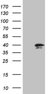 PRTN3 / Myeloblastin Antibody - HEK293T cells were transfected with the pCMV6-ENTRY control (Left lane) or pCMV6-ENTRY PRTN3 (Right lane) cDNA for 48 hrs and lysed. Equivalent amounts of cell lysates (5 ug per lane) were separated by SDS-PAGE and immunoblotted with anti-PRTN3 (1:2000).