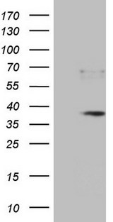 PRTN3 / Myeloblastin Antibody - HEK293T cells were transfected with the pCMV6-ENTRY control. (Left lane) or pCMV6-ENTRY PRTN3. (Right lane) cDNA for 48 hrs and lysed. Equivalent amounts of cell lysates. (5 ug per lane) were separated by SDS-PAGE and immunoblotted with anti-PRTN3.