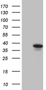 PRTN3 / Myeloblastin Antibody - HEK293T cells were transfected with the pCMV6-ENTRY control. (Left lane) or pCMV6-ENTRY PRTN3. (Right lane) cDNA for 48 hrs and lysed. Equivalent amounts of cell lysates. (5 ug per lane) were separated by SDS-PAGE and immunoblotted with anti-PRTN3. (1:500)