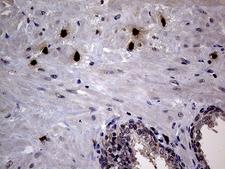 PRTN3 / Myeloblastin Antibody - Immunohistochemical staining of paraffin-embedded Human prostate tissue within the normal limits using anti-PRTN3 mouse monoclonal antibody. (Heat-induced epitope retrieval by 1mM EDTA in 10mM Tris buffer. (pH8.5) at 120°C for 3 min. (1:2000)