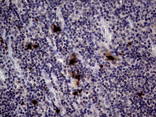 PRTN3 / Myeloblastin Antibody - Immunohistochemical staining of paraffin-embedded Human tonsil within the normal limits using anti-PRTN3 mouse monoclonal antibody. (Heat-induced epitope retrieval by 1mM EDTA in 10mM Tris buffer. (pH8.5) at 120°C for 3 min. (1:2000)