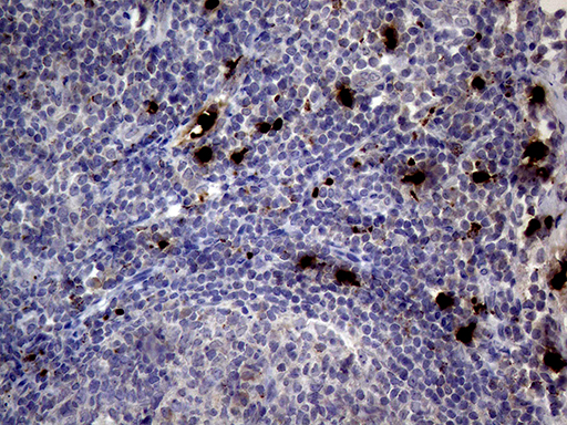 PRTN3 / Myeloblastin Antibody - Immunohistochemical staining of paraffin-embedded Human lymph node tissue within the normal limits using anti-PRTN3 mouse monoclonal antibody. (Heat-induced epitope retrieval by 1mM EDTA in 10mM Tris buffer. (pH8.5) at 120°C for 3 min. (1:2000)