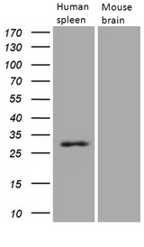 PRTN3 / Myeloblastin Antibody - Western blot analysis of extracts. (15ug) from human spleen tissue lysate and mouse brain tissue lysate by using anti-PRTN3 monoclonal antibody. (1:500)