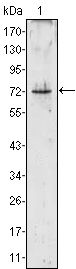 PRTN3 / Myeloblastin Antibody - PR3 Antibody in Western Blot (WB)