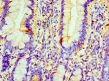 PRUNE Antibody - Immunohistochemistry of paraffin-embedded human small intestine tissue using antibody at 1:100 dilution.  This image was taken for the unconjugated form of this product. Other forms have not been tested.