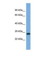 PRUNE Antibody - Western blot of Human COLO205. PRUNE antibody dilution 1.0 ug/ml.  This image was taken for the unconjugated form of this product. Other forms have not been tested.