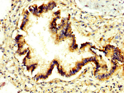 PRUNE Antibody - IHC image of PRUNE Antibody diluted at 1:300 and staining in paraffin-embedded human lung tissue performed on a Leica BondTM system. After dewaxing and hydration, antigen retrieval was mediated by high pressure in a citrate buffer (pH 6.0). Section was blocked with 10% normal goat serum 30min at RT. Then primary antibody (1% BSA) was incubated at 4°C overnight. The primary is detected by a biotinylated secondary antibody and visualized using an HRP conjugated SP system.