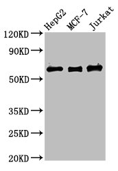 PRUNE Antibody - Western Blot Positive WB detected in: HepG2 whole cell lysate, MCF-7 whole cell lysate, Jurkat whole cell lysate All lanes: PRUNE antibody at 4µg/ml Secondary Goat polyclonal to rabbit IgG at 1/50000 dilution Predicted band size: 51, 43, 31, 27, 25, 19 kDa Observed band size: 60 kDa