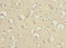 PRUNE2 Antibody - Immunohistochemistry of paraffin-embedded human brain tissue at dilution 1:100