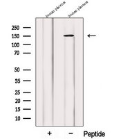 PRUNE2 Antibody - Western blot analysis of extracts of human placenta extracts using PRUNE2 antibody. The lane on the left was treated with blocking peptide.