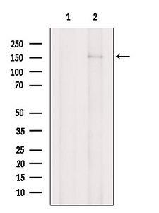 PRUNE2 Antibody - Western blot analysis of extracts of COLO205 cells using PRUNE2 antibody. The lane on the left was treated with blocking peptide.