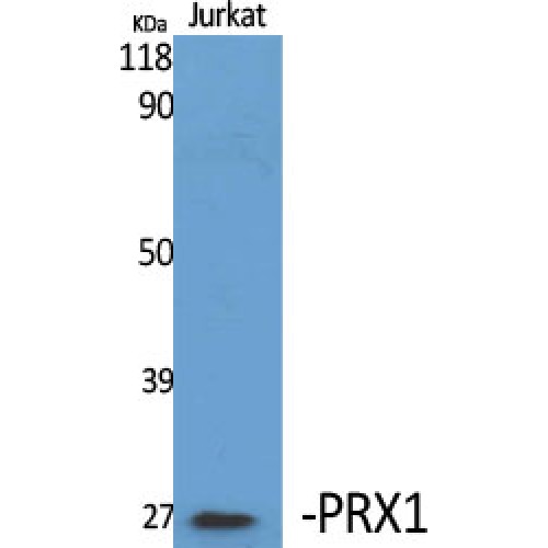 PRX-1 / PRRX1 Antibody - Western blot of PRX1 antibody