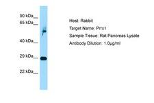 PRX-1 / PRRX1 Antibody -  This image was taken for the unconjugated form of this product. Other forms have not been tested.