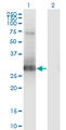 PRX-1 / PRRX1 Antibody - Western Blot analysis of PRRX1 expression in transfected 293T cell line by PRRX1 monoclonal antibody (M01), clone 1E2.Lane 1: PRRX1 transfected lysate (Predicted MW: 24.4 KDa).Lane 2: Non-transfected lysate.