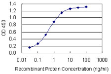 PRX-1 / PRRX1 Antibody - Detection limit for recombinant GST tagged PRRX1 is 0.03 ng/ml as a capture antibody.