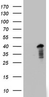 PRX-1 / PRRX1 Antibody - HEK293T cells were transfected with the pCMV6-ENTRY control (Left lane) or pCMV6-ENTRY PRRX1 (Right lane) cDNA for 48 hrs and lysed. Equivalent amounts of cell lysates (5 ug per lane) were separated by SDS-PAGE and immunoblotted with anti-PRRX1.