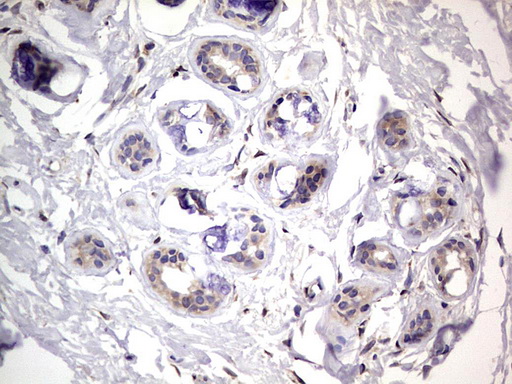 PRX-1 / PRRX1 Antibody - IHC of paraffin-embedded Human breast tissue using anti-PRRX1 mouse monoclonal antibody. (Heat-induced epitope retrieval by 1 mM EDTA in 10mM Tris, pH8.5, 120°C for 3min).