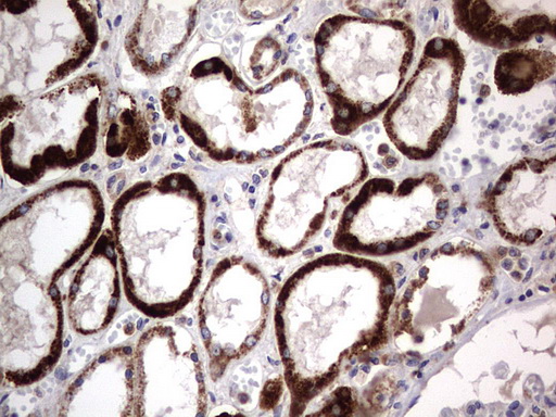 PRX-1 / PRRX1 Antibody - IHC of paraffin-embedded Human Kidney tissue using anti-PRRX1 mouse monoclonal antibody. (Heat-induced epitope retrieval by 1 mM EDTA in 10mM Tris, pH8.5, 120°C for 3min).