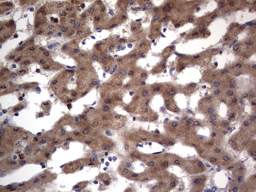 PRX-1 / PRRX1 Antibody - IHC of paraffin-embedded Human liver tissue using anti-PRRX1 mouse monoclonal antibody. (Heat-induced epitope retrieval by 1 mM EDTA in 10mM Tris, pH8.5, 120°C for 3min).