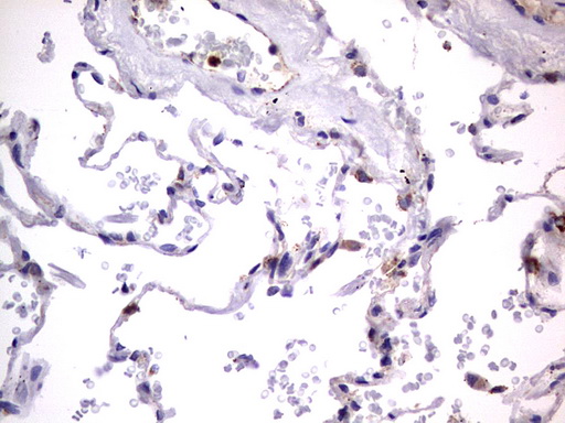 PRX-1 / PRRX1 Antibody - IHC of paraffin-embedded Human lung tissue using anti-PRRX1 mouse monoclonal antibody. (Heat-induced epitope retrieval by 1 mM EDTA in 10mM Tris, pH8.5, 120°C for 3min).