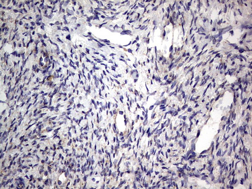 PRX-1 / PRRX1 Antibody - IHC of paraffin-embedded Human Ovary tissue using anti-PRRX1 mouse monoclonal antibody. (Heat-induced epitope retrieval by 1 mM EDTA in 10mM Tris, pH8.5, 120°C for 3min).