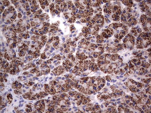 PRX-1 / PRRX1 Antibody - IHC of paraffin-embedded Human pancreas tissue using anti-PRRX1 mouse monoclonal antibody. (Heat-induced epitope retrieval by 1 mM EDTA in 10mM Tris, pH8.5, 120°C for 3min).