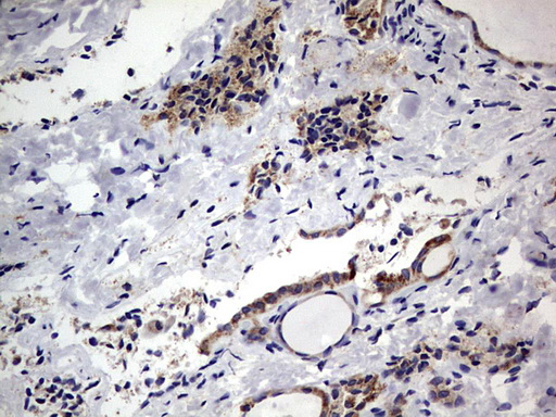 PRX-1 / PRRX1 Antibody - IHC of paraffin-embedded Human thyroid tissue using anti-PRRX1 mouse monoclonal antibody. (Heat-induced epitope retrieval by 1 mM EDTA in 10mM Tris, pH8.5, 120°C for 3min).