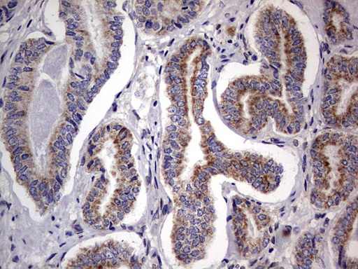PRX-1 / PRRX1 Antibody - IHC of paraffin-embedded Human prostate tissue using anti-PRRX1 mouse monoclonal antibody. (Heat-induced epitope retrieval by 1 mM EDTA in 10mM Tris, pH8.5, 120°C for 3min).