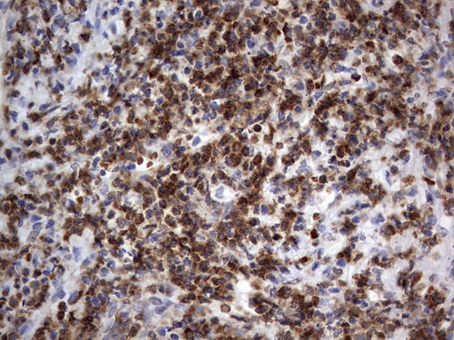 PRX-1 / PRRX1 Antibody - IHC of paraffin-embedded Human lymph node tissue using anti-PRRX1 mouse monoclonal antibody. (Heat-induced epitope retrieval by 1 mM EDTA in 10mM Tris, pH8.5, 120°C for 3min).